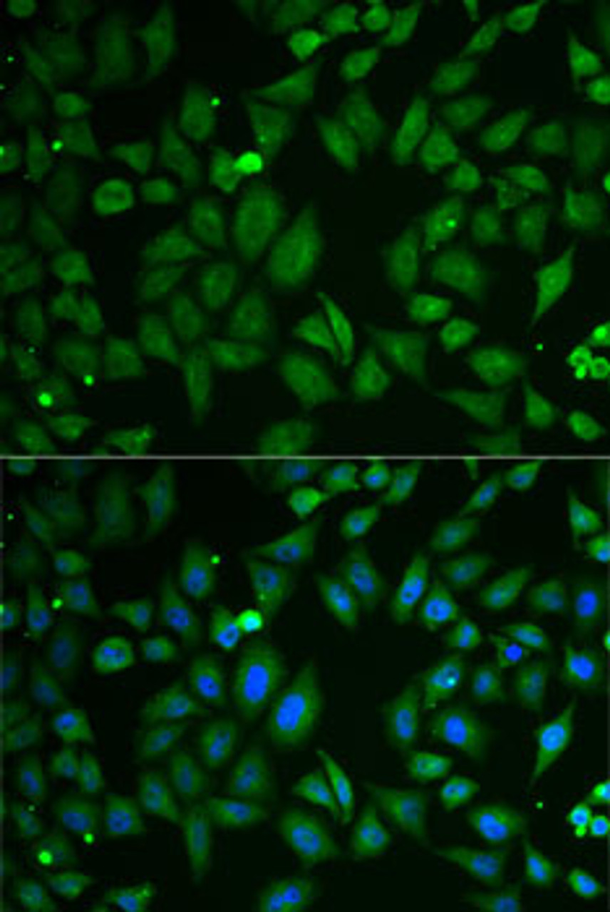 Immunofluorescence analysis of U2OS cells using SCG2 antibody (22-211) . Blue: DAPI for nuclear staining.