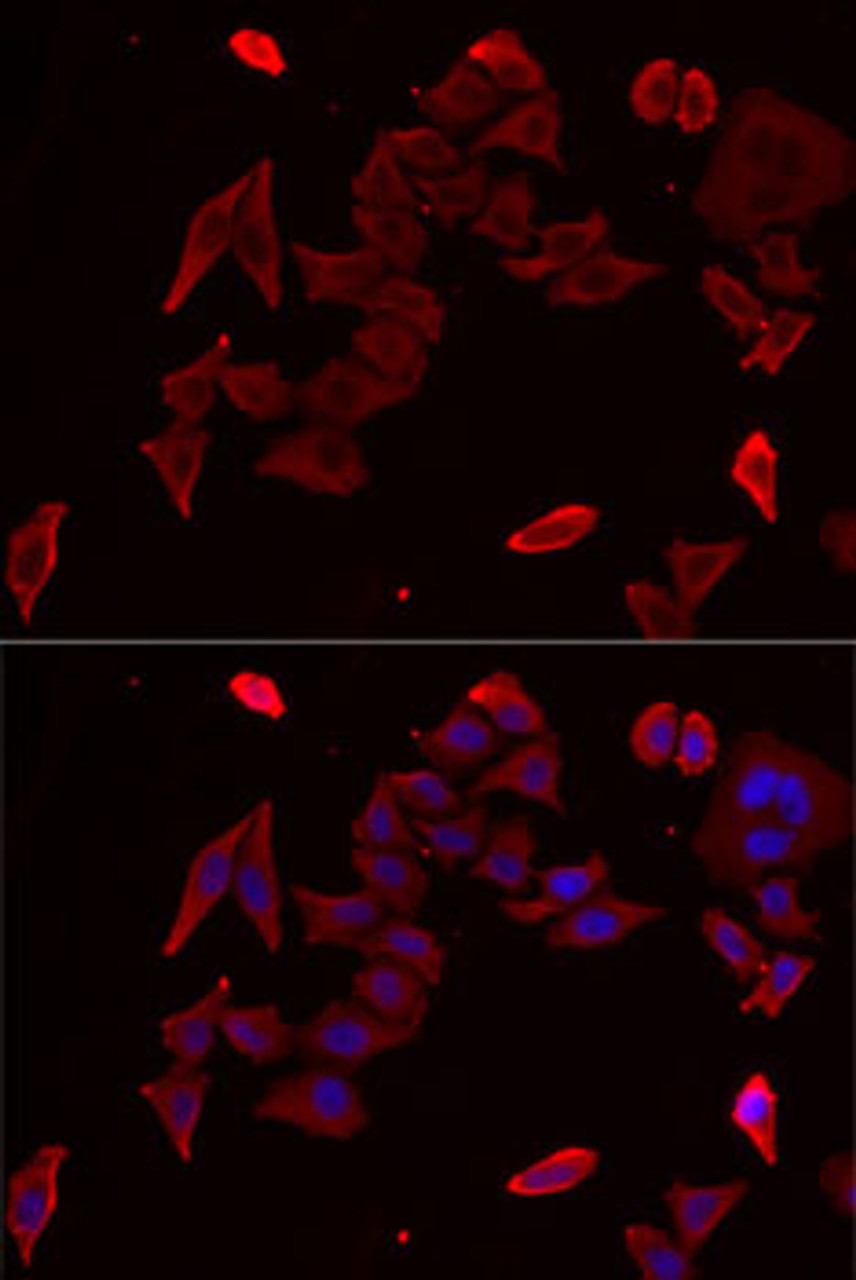 Immunofluorescence analysis of MCF7 cells using PDHX antibody (22-212) . Blue: DAPI for nuclear staining.