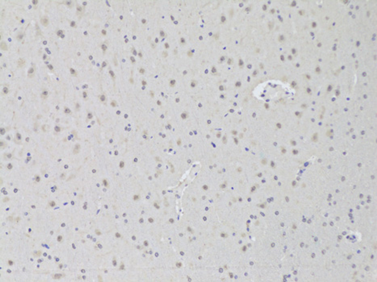 Immunohistochemistry of paraffin-embedded rat brain using AAAS Antibody (22-213) at dilution of 1:100 (20x lens) .
