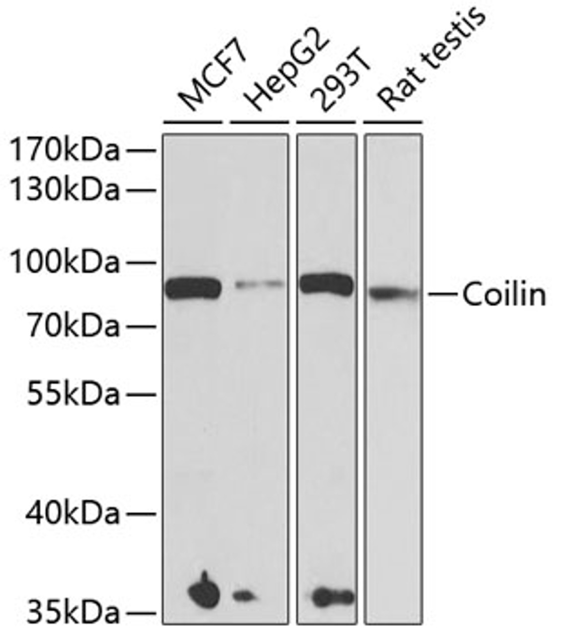Western blot analysis of extracts of various cell lines, using Coilin antibody (22-214) at 1:1000 dilution.<br/>Secondary antibody: HRP Goat Anti-Rabbit IgG (H+L) at 1:10000 dilution.<br/>Lysates/proteins: 25ug per lane.<br/>Blocking buffer: 3% nonfat dry milk in TBST.<br/>Detection: ECL Basic Kit.<br/>Exposure time: 90s.