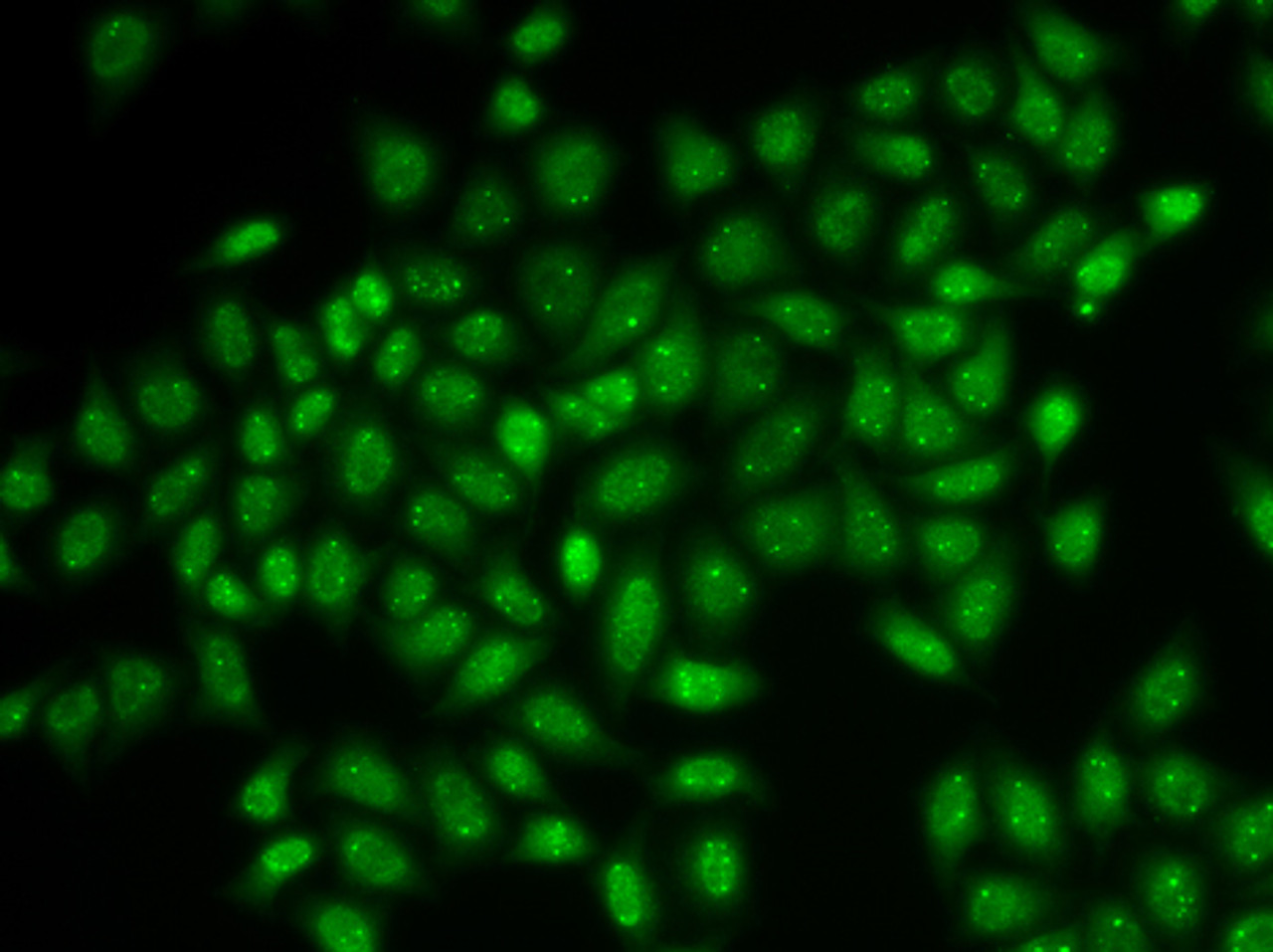 Immunofluorescence analysis of HeLa cells using Coilin antibody (22-214) .