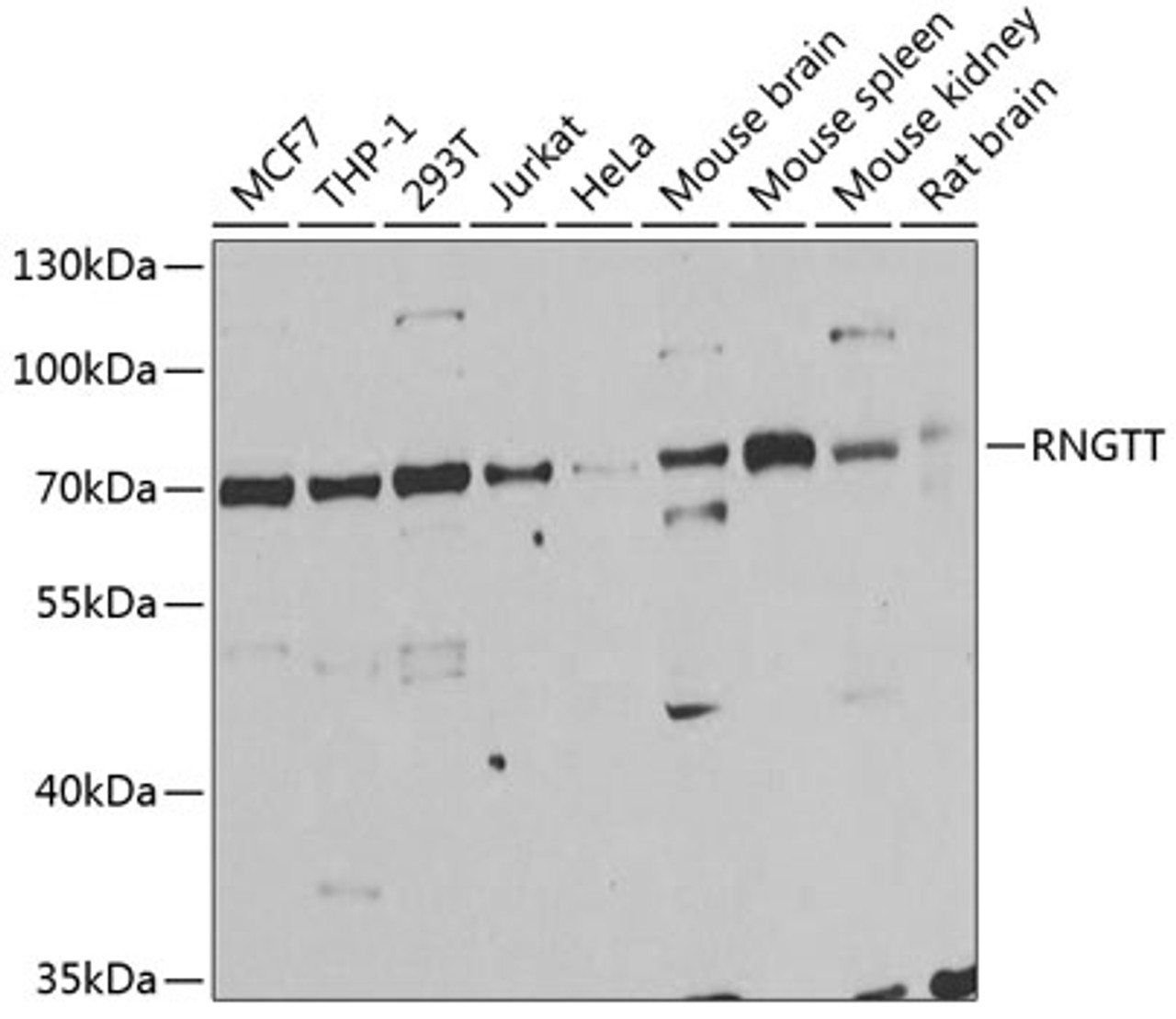 Western blot analysis of extracts of various cell lines, using RNGTT antibody (22-217) at 1:1000 dilution.<br/>Secondary antibody: HRP Goat Anti-Rabbit IgG (H+L) at 1:10000 dilution.<br/>Lysates/proteins: 25ug per lane.<br/>Blocking buffer: 3% nonfat dry milk in TBST.<br/>Detection: ECL Basic Kit.<br/>Exposure time: 90s.