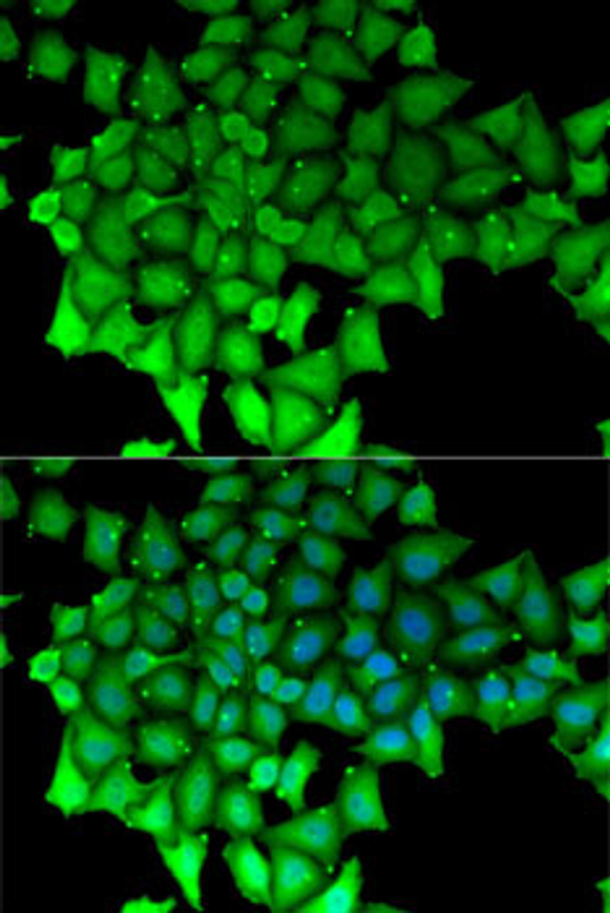 Immunofluorescence analysis of MCF7 cells using RNGTT antibody (22-217) . Blue: DAPI for nuclear staining.