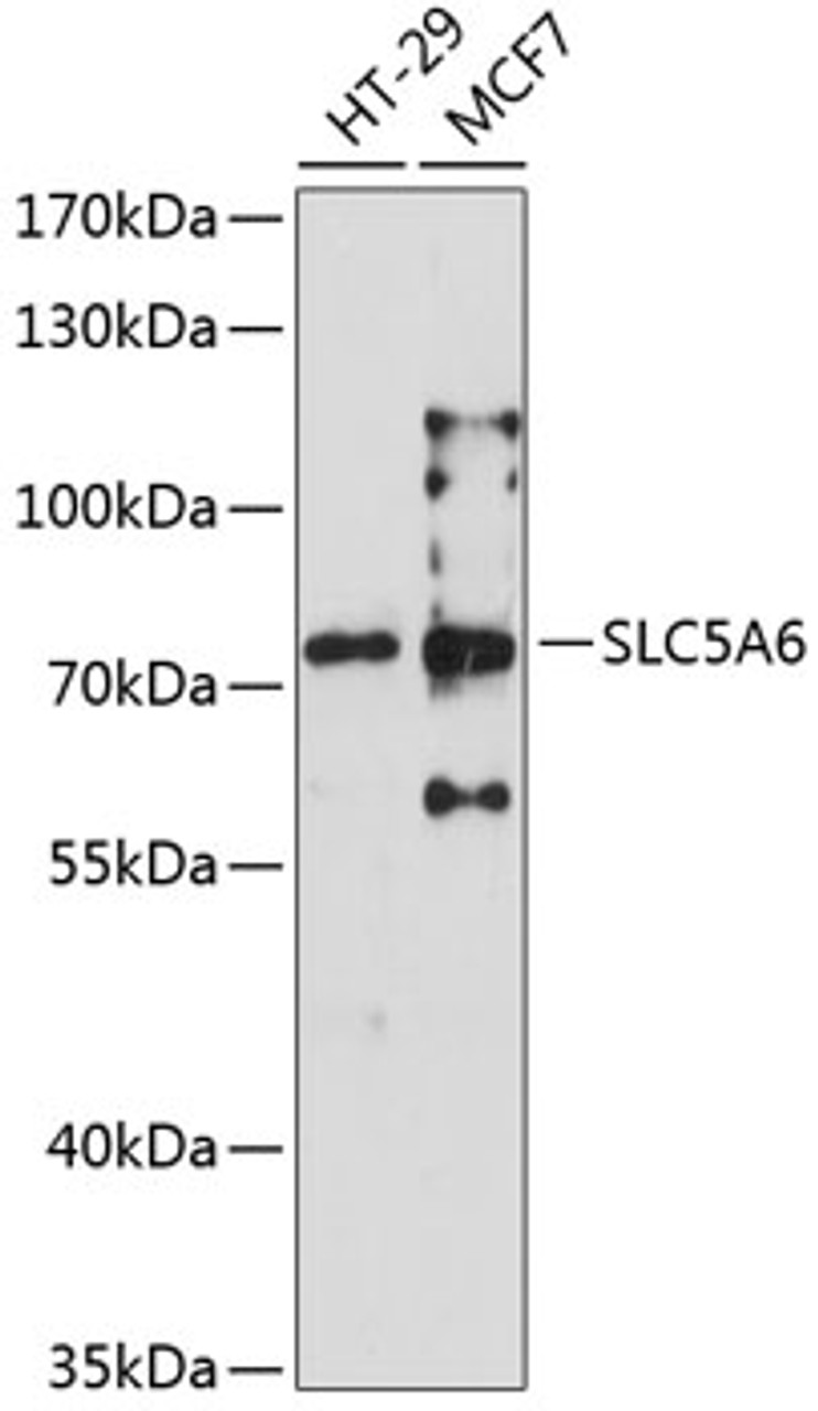 Western blot analysis of extracts of various cell lines, using SLC5A6 antibody (22-219) at 1:3000 dilution._Secondary antibody: HRP Goat Anti-Rabbit IgG (H+L) at 1:10000 dilution._Lysates/proteins: 25ug per lane._Blocking buffer: 3% nonfat dry milk in TBST._Detection: ECL Enhanced Kit._Exposure time: 90s.