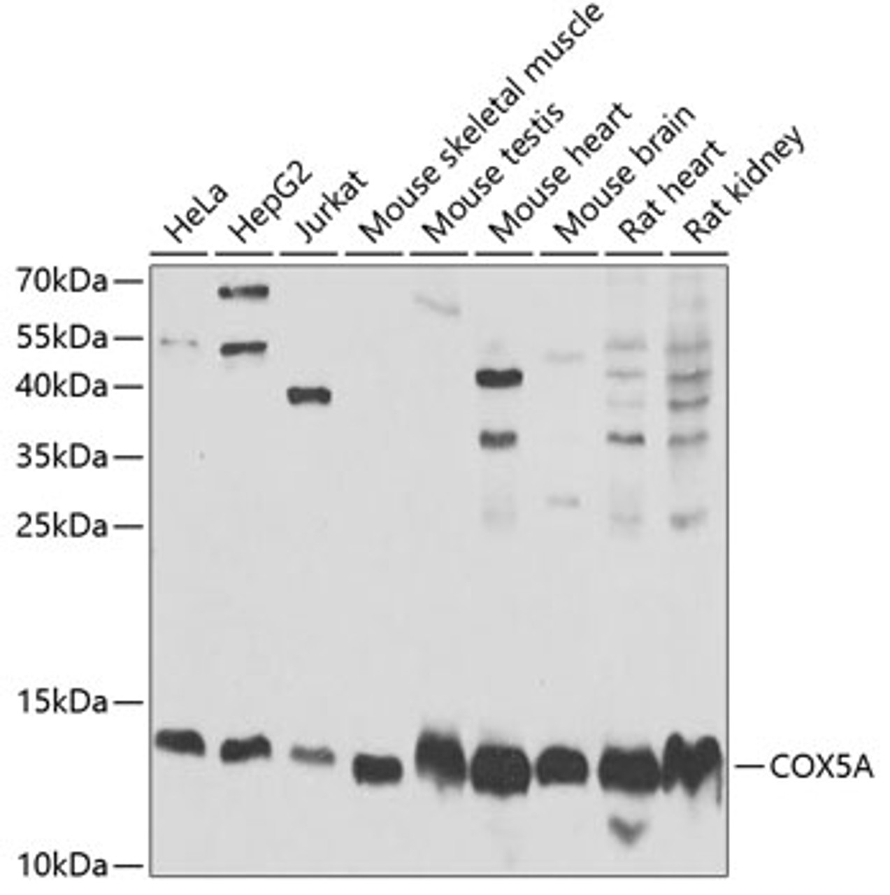 Western blot analysis of extracts of various cell lines, using COX5A Antibody (22-221) at 1:1000 dilution.<br/>Secondary antibody: HRP Goat Anti-Rabbit IgG (H+L) at 1:10000 dilution.<br/>Lysates/proteins: 25ug per lane.<br/>Blocking buffer: 3% nonfat dry milk in TBST.<br/>Detection: ECL Basic Kit.<br/>Exposure time: 30s.