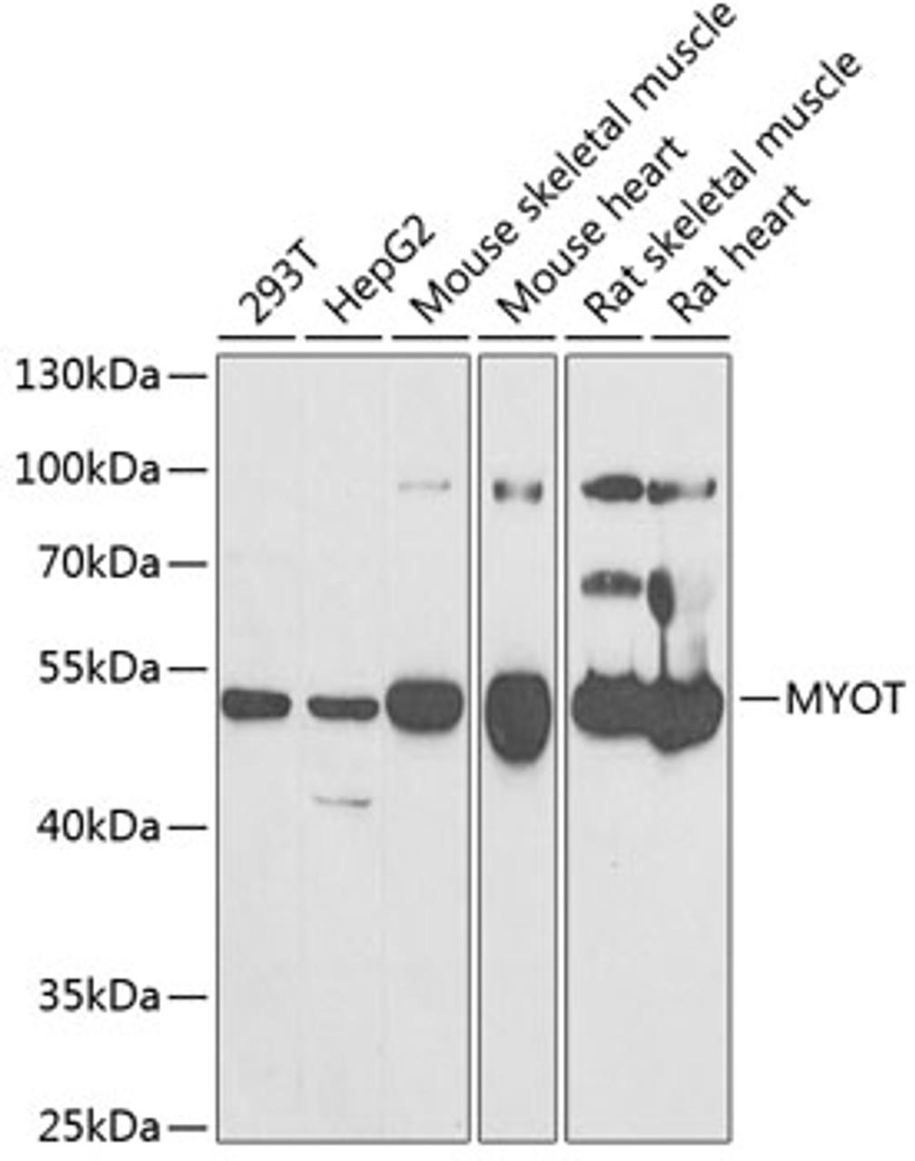 Western blot analysis of extracts of various cell lines, using MYOT antibody (22-222) at 1:1000 dilution._Secondary antibody: HRP Goat Anti-Rabbit IgG (H+L) at 1:10000 dilution._Lysates/proteins: 25ug per lane._Blocking buffer: 3% nonfat dry milk in TBST._Detection: ECL Enhanced Kit._Exposure time: 90s.