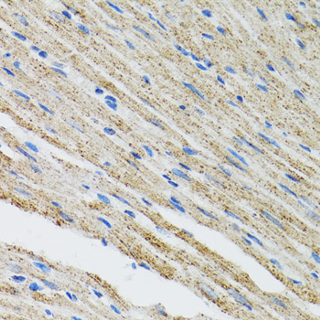 Immunohistochemistry of paraffin-embedded mouse heart using MYOT antibody (22-222) at dilution of 1:100 (40x lens) .
