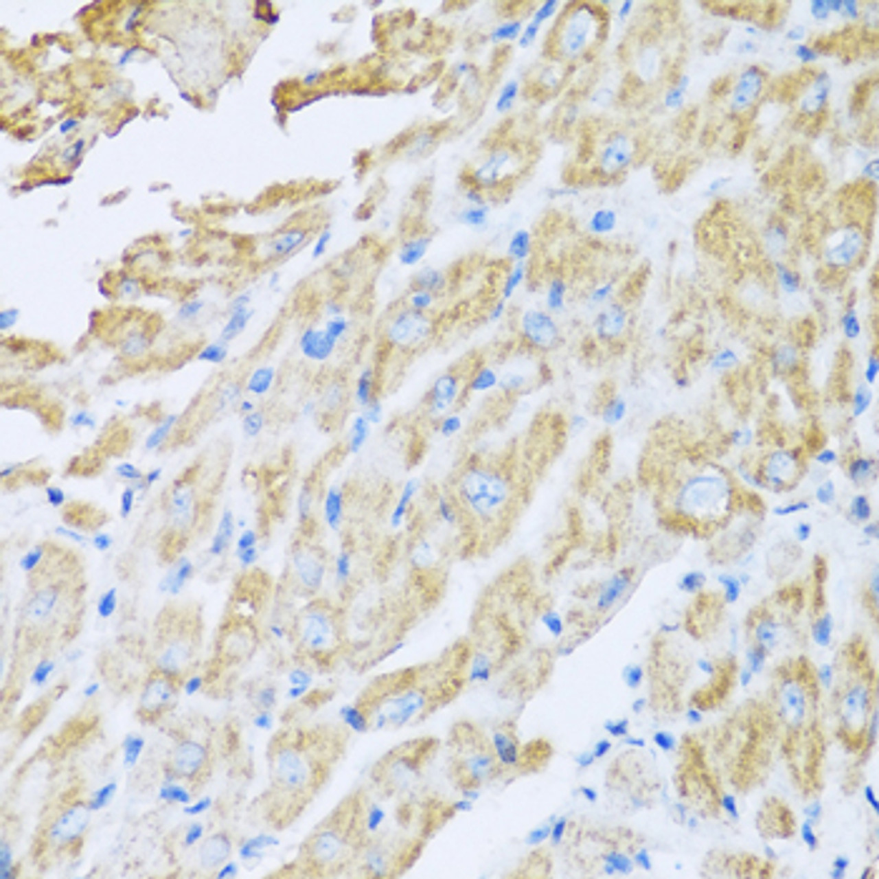 Immunohistochemistry of paraffin-embedded mouse heart using IL18BP antibody (22-228) at dilution of 1:100 (40x lens) .