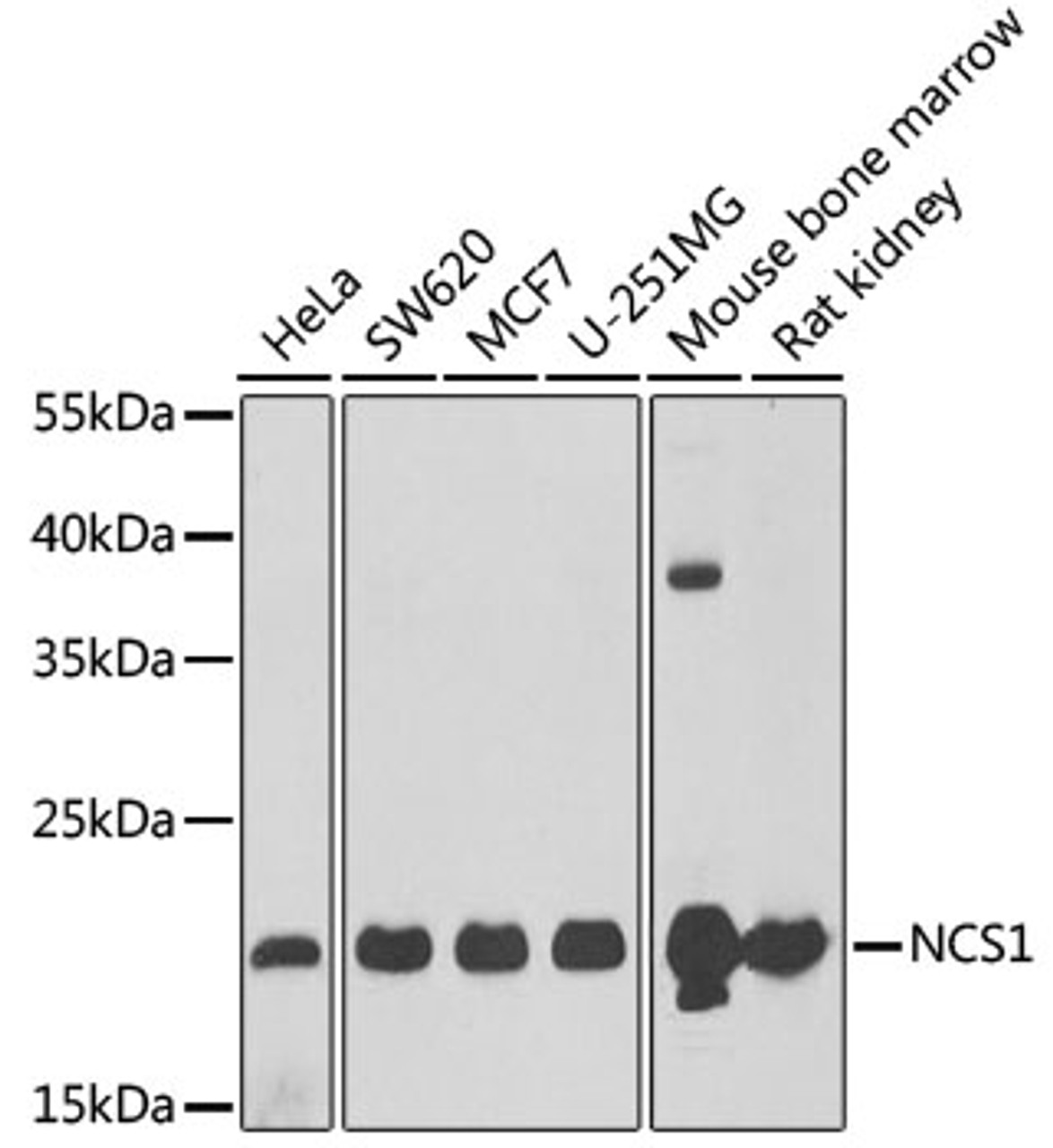Western blot analysis of extracts of various cell lines, using NCS1 antibody (22-237) at 1:1000 dilution.<br/>Secondary antibody: HRP Goat Anti-Rabbit IgG (H+L) at 1:10000 dilution.<br/>Lysates/proteins: 25ug per lane.<br/>Blocking buffer: 3% nonfat dry milk in TBST.<br/>Detection: ECL Basic Kit.<br/>Exposure time: 90s.