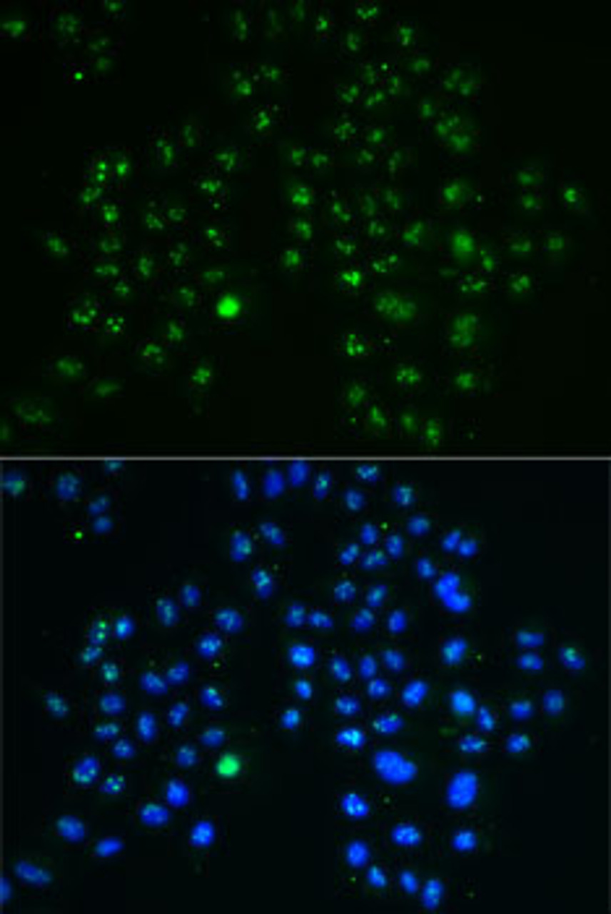 Immunofluorescence analysis of MCF7 cells using GNL3 antibody (22-239) . Blue: DAPI for nuclear staining.