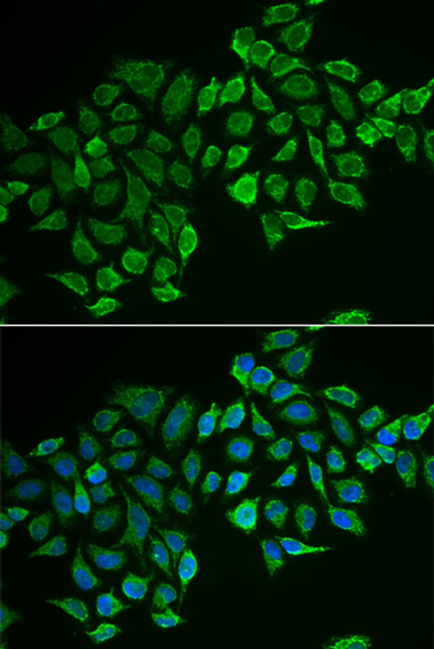 Immunofluorescence analysis of MCF-7 cells using RHOD antibody (22-243) . Blue: DAPI for nuclear staining.