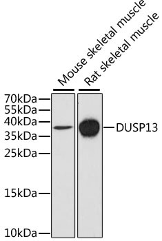 Western blot analysis of extracts of various cell lines, using DUSP13 antibody (22-244) at 1:1000 dilution.<br/>Secondary antibody: HRP Goat Anti-Rabbit IgG (H+L) at 1:10000 dilution.<br/>Lysates/proteins: 25ug per lane.<br/>Blocking buffer: 3% nonfat dry milk in TBST.<br/>Detection: ECL Basic Kit.<br/>Exposure time: 90s.
