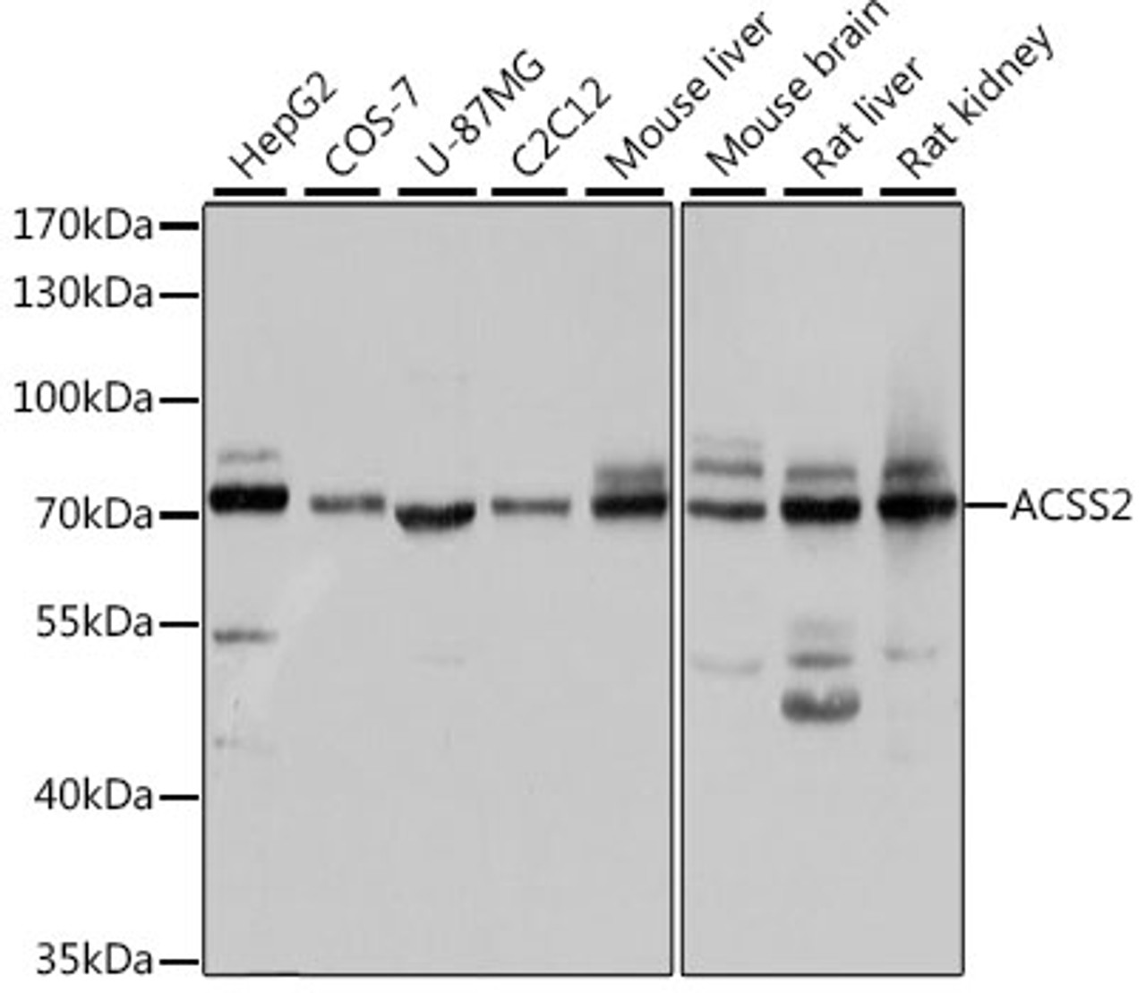 Western blot analysis of extracts of various cell lines, using ACSS2 antibody (22-251) at 1:1000 dilution.<br/>Secondary antibody: HRP Goat Anti-Rabbit IgG (H+L) at 1:10000 dilution.<br/>Lysates/proteins: 25ug per lane.<br/>Blocking buffer: 3% nonfat dry milk in TBST.<br/>Detection: ECL Basic Kit.<br/>Exposure time: 5s.