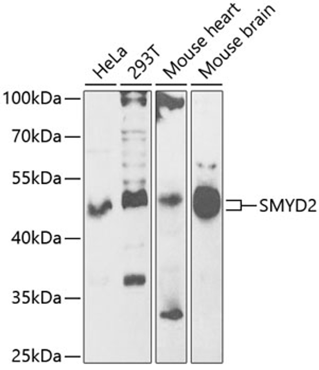 Western blot analysis of extracts of various cell lines, using SMYD2 antibody (22-253) at 1:1000 dilution.<br/>Secondary antibody: HRP Goat Anti-Rabbit IgG (H+L) at 1:10000 dilution.<br/>Lysates/proteins: 25ug per lane.<br/>Blocking buffer: 3% nonfat dry milk in TBST.<br/>Detection: ECL Basic Kit.<br/>Exposure time: 60s.