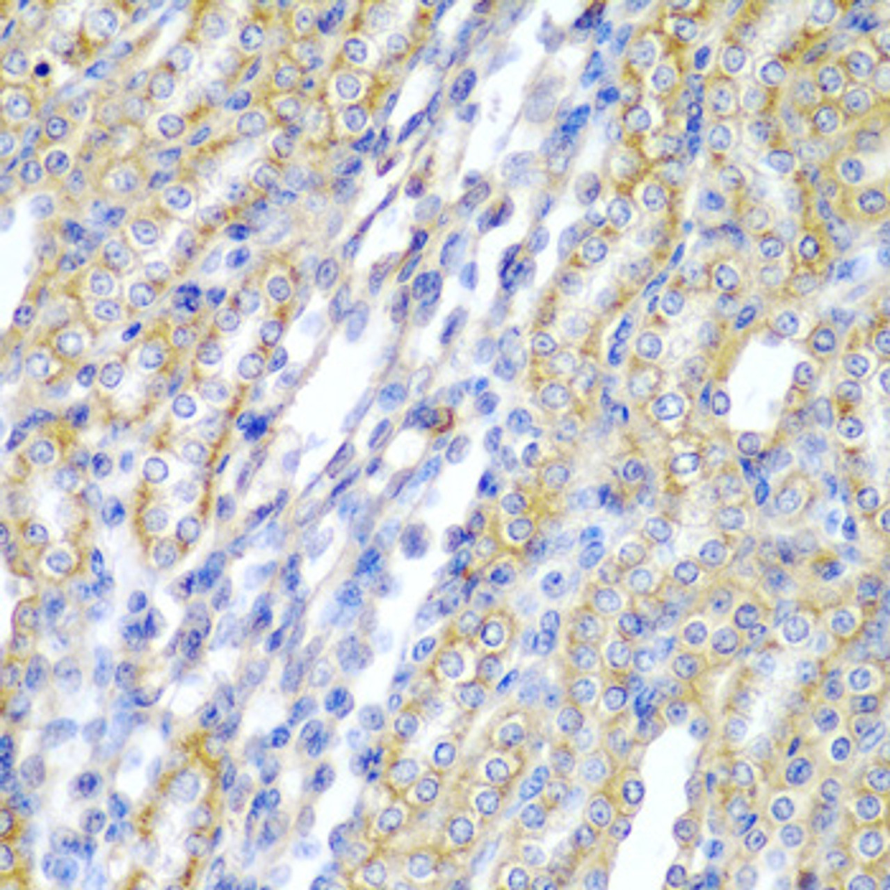 Immunohistochemistry of paraffin-embedded rat kidney using CYP20A1 antibody (22-254) at dilution of 1:200 (40x lens) .