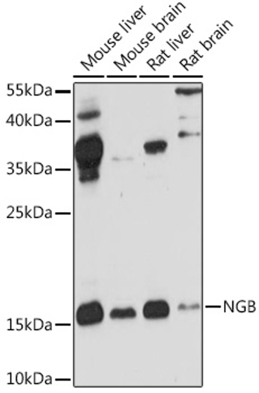 Western blot analysis of extracts of various cell lines, using NGB antibody (22-255) at 1:1000 dilution.<br/>Secondary antibody: HRP Goat Anti-Rabbit IgG (H+L) at 1:10000 dilution.<br/>Lysates/proteins: 25ug per lane.<br/>Blocking buffer: 3% nonfat dry milk in TBST.<br/>Detection: ECL Basic Kit.<br/>Exposure time: 90s.