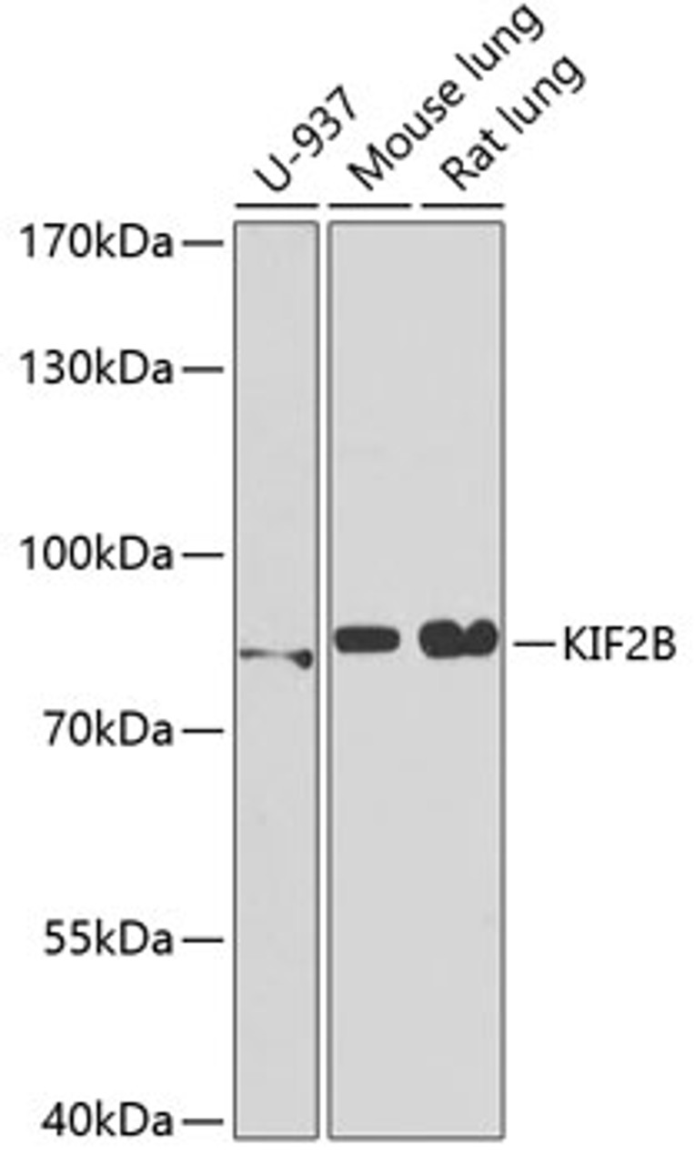 Western blot analysis of extracts of various cell lines, using KIF2B antibody (22-256) at 1:1000 dilution.<br/>Secondary antibody: HRP Goat Anti-Rabbit IgG (H+L) at 1:10000 dilution.<br/>Lysates/proteins: 25ug per lane.<br/>Blocking buffer: 3% nonfat dry milk in TBST.<br/>Detection: ECL Basic Kit.<br/>Exposure time: 30s.