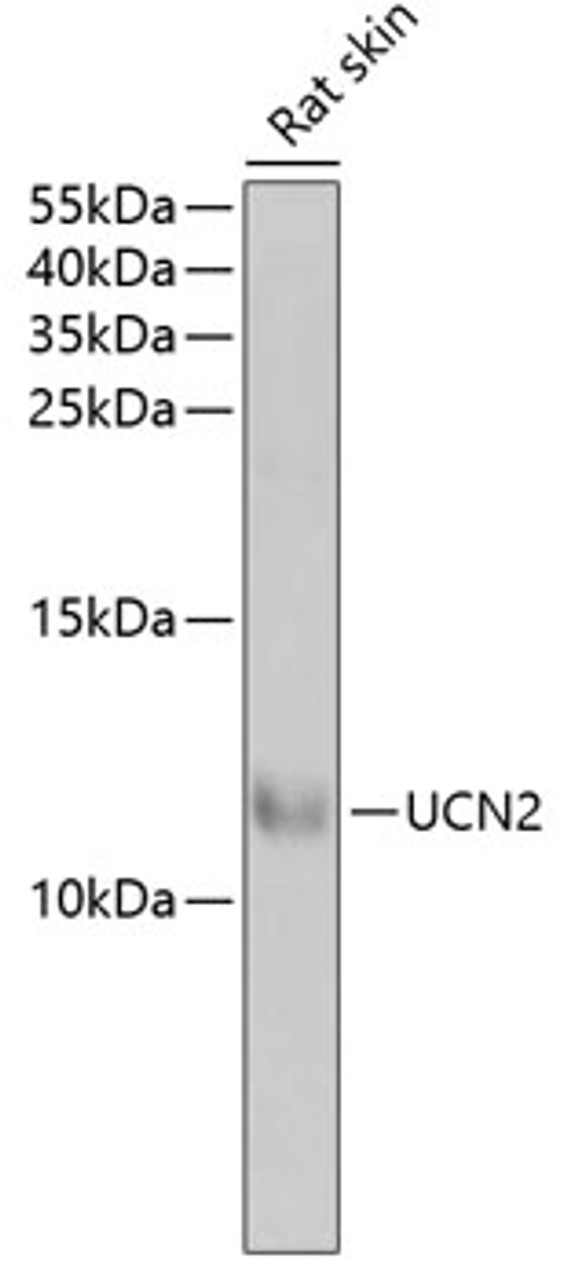 Western blot analysis of extracts of rat skin, using UCN2 antibody (22-258) at 1:1000 dilution.<br/>Secondary antibody: HRP Goat Anti-Rabbit IgG (H+L) at 1:10000 dilution.<br/>Lysates/proteins: 25ug per lane.<br/>Blocking buffer: 3% nonfat dry milk in TBST.<br/>Detection: ECL Basic Kit.<br/>Exposure time: 90s.
