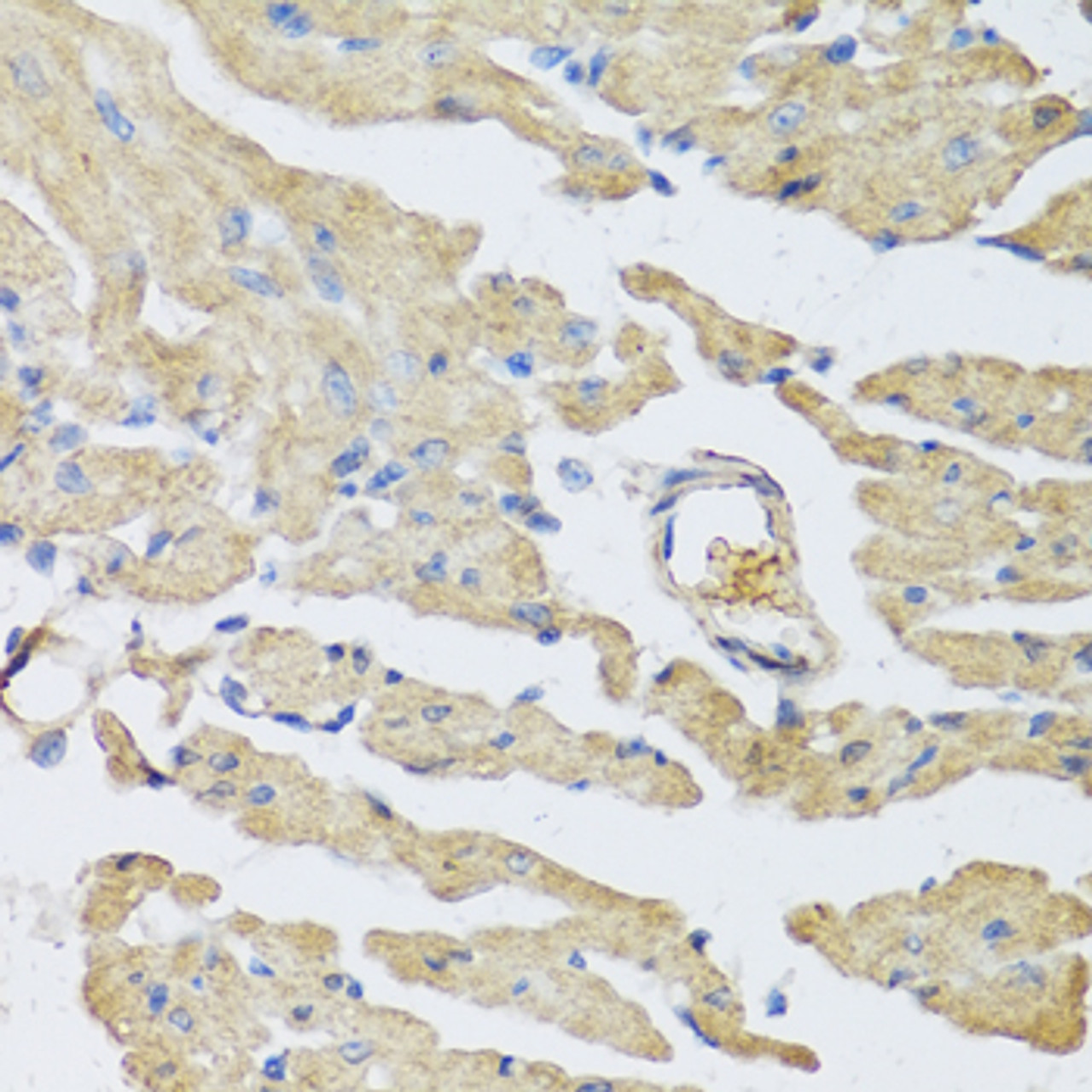 Immunohistochemistry of paraffin-embedded mouse heart using UCN2 antibody (22-258) at dilution of 1:100 (40x lens) .