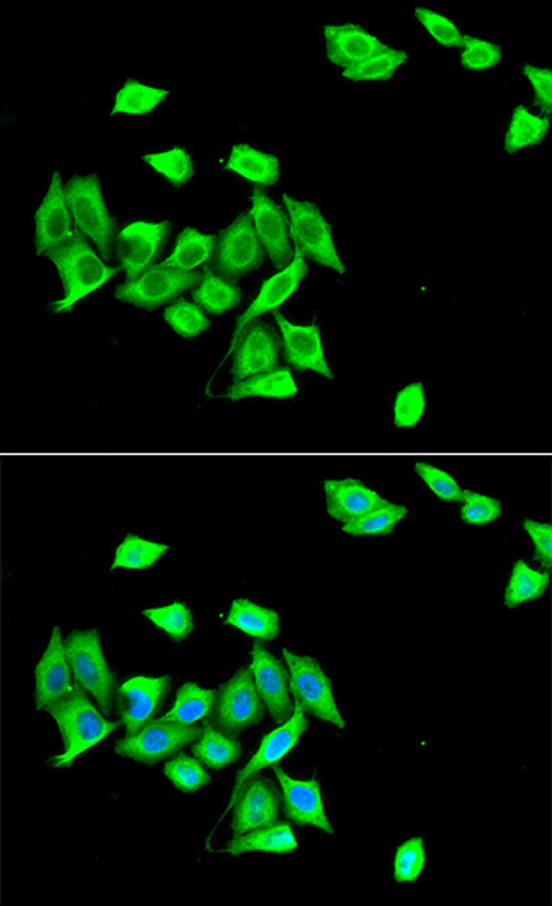 Immunofluorescence analysis of A549 cells using DNMT3A antibody (22-271) . Blue: DAPI for nuclear staining.