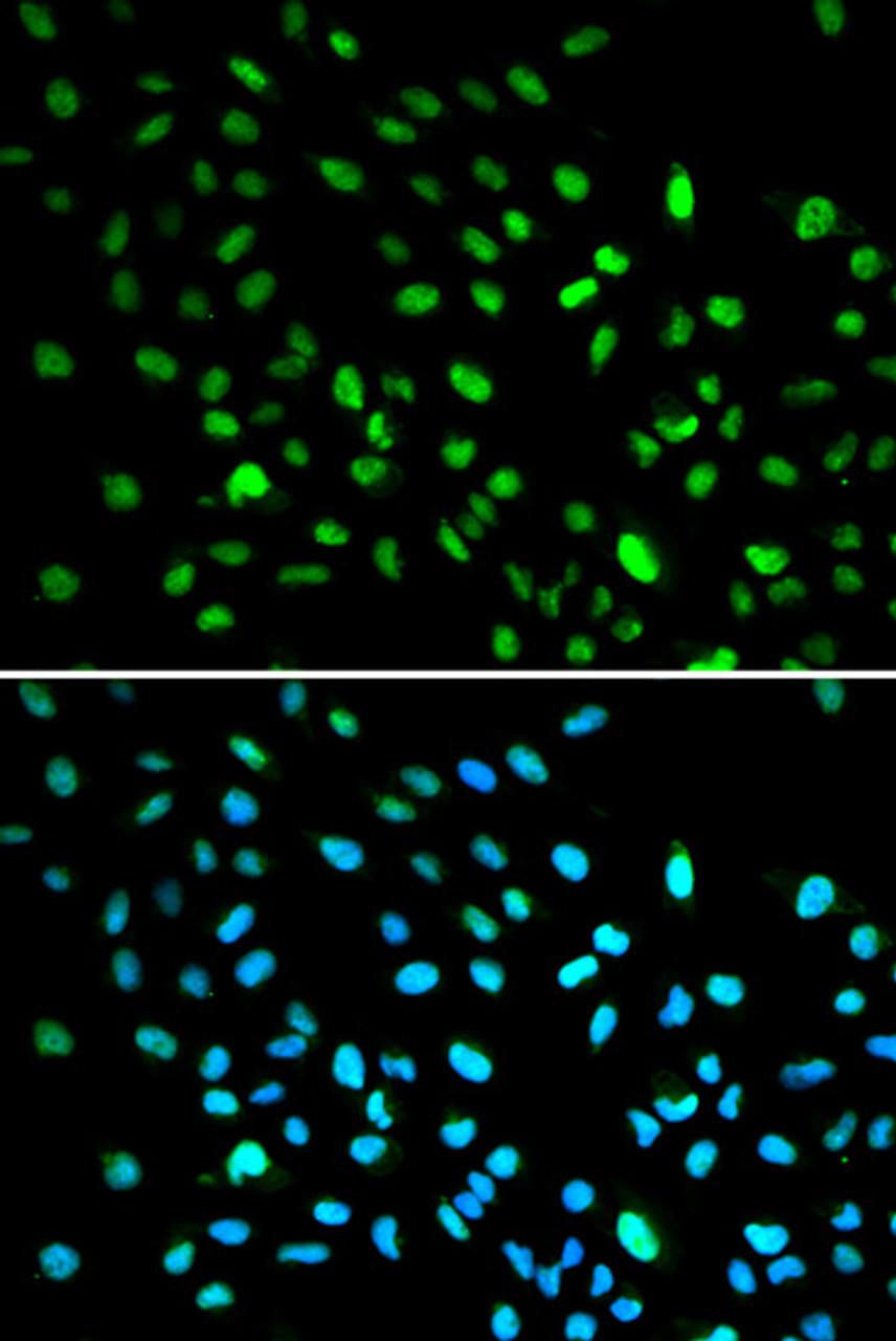 Immunofluorescence analysis of A549 cells using DDIT3 / CHOP antibody (22-272) . Blue: DAPI for nuclear staining.