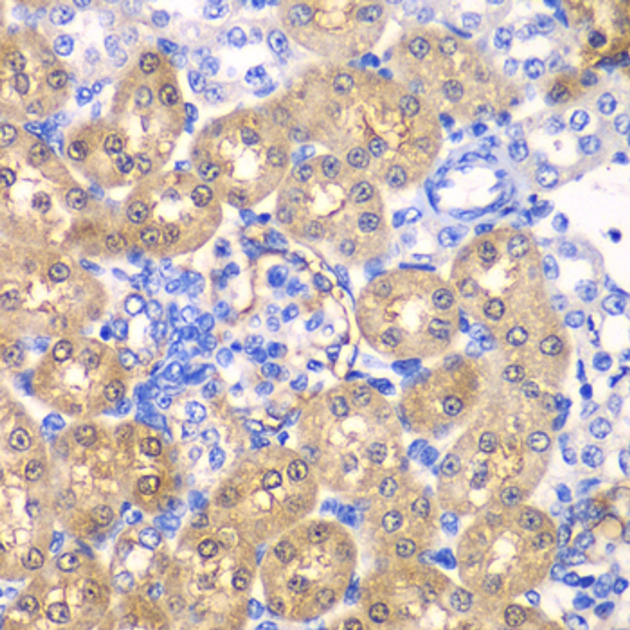 Immunohistochemistry of paraffin-embedded rat kidney using HPD antibody (22-273) at dilution of 1:100 (40x lens) .