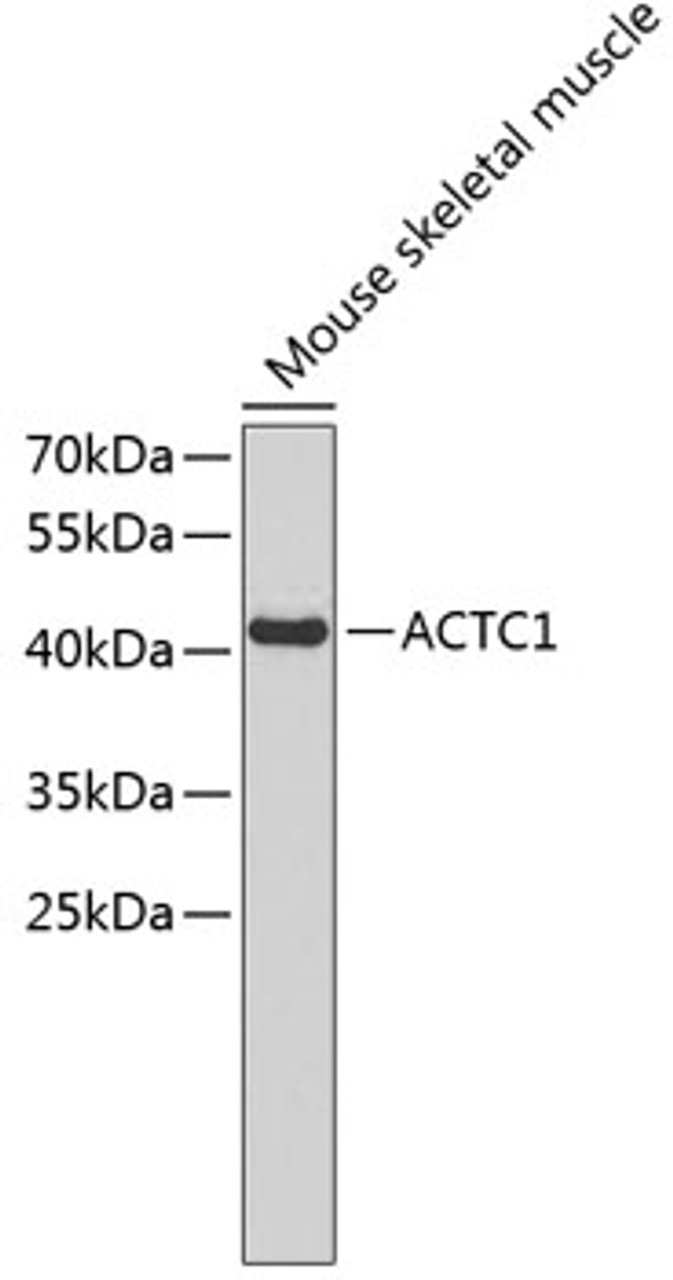 Western blot analysis of extracts of mouse skeletal muscle, using ACTC1 antibody (22-274) .<br/>Secondary antibody: HRP Goat Anti-Rabbit IgG (H+L) at 1:10000 dilution.<br/>Lysates/proteins: 25ug per lane.<br/>Blocking buffer: 3% nonfat dry milk in TBST.