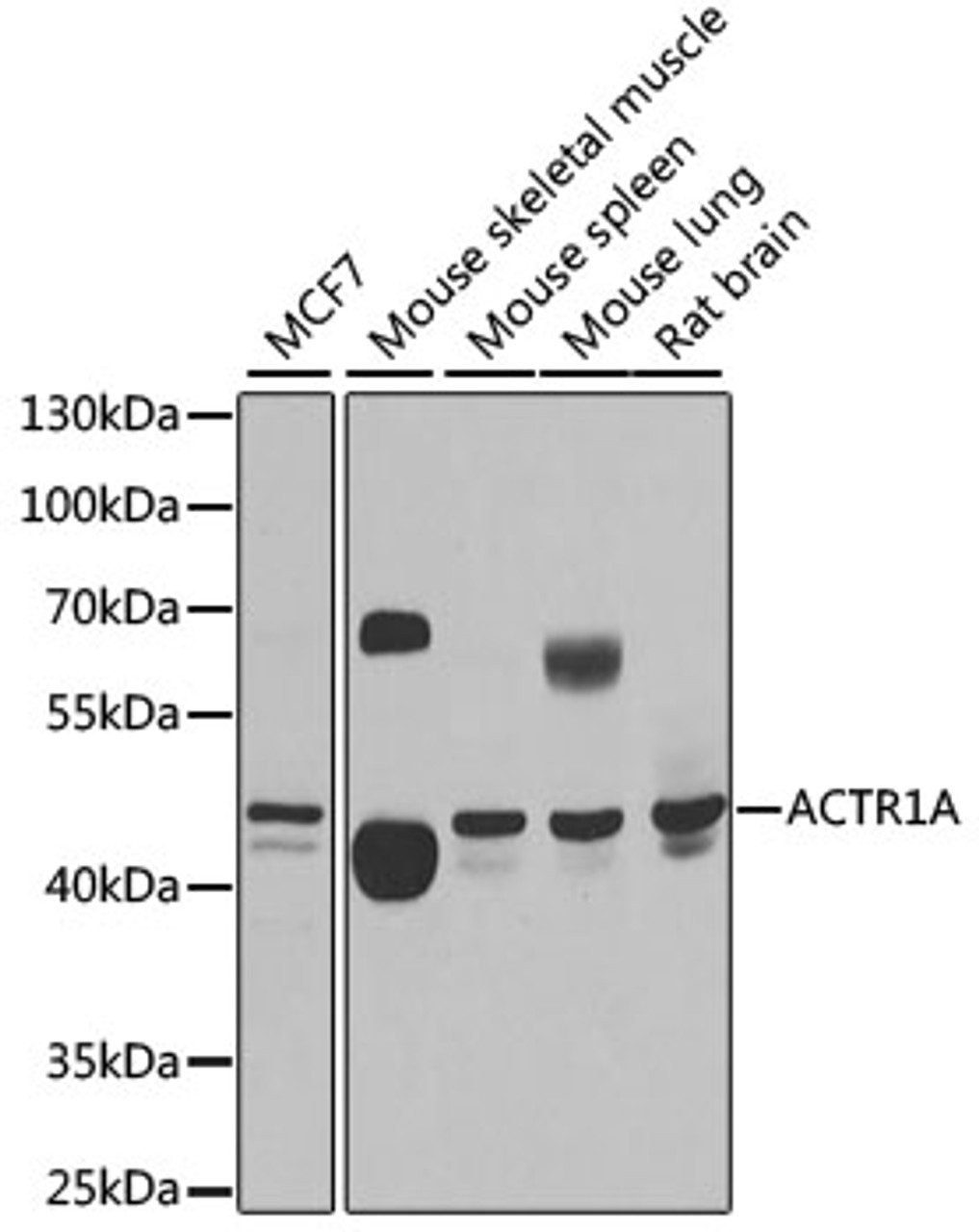 Western blot analysis of extracts of various cell lines, using ACTR1A antibody (22-277) at 1:1000 dilution.<br/>Secondary antibody: HRP Goat Anti-Rabbit IgG (H+L) at 1:10000 dilution.<br/>Lysates/proteins: 25ug per lane.<br/>Blocking buffer: 3% nonfat dry milk in TBST.<br/>Detection: ECL Basic Kit.<br/>Exposure time: 5s.