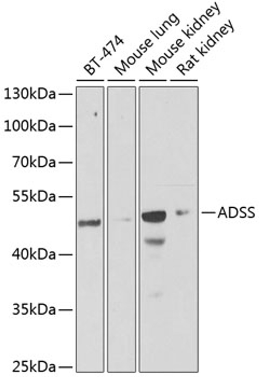 Western blot analysis of extracts of various cell lines, using ADSS antibody (22-278) at 1:1000 dilution.<br/>Secondary antibody: HRP Goat Anti-Rabbit IgG (H+L) at 1:10000 dilution.<br/>Lysates/proteins: 25ug per lane.<br/>Blocking buffer: 3% nonfat dry milk in TBST.<br/>Detection: ECL Basic Kit.<br/>Exposure time: 90s.
