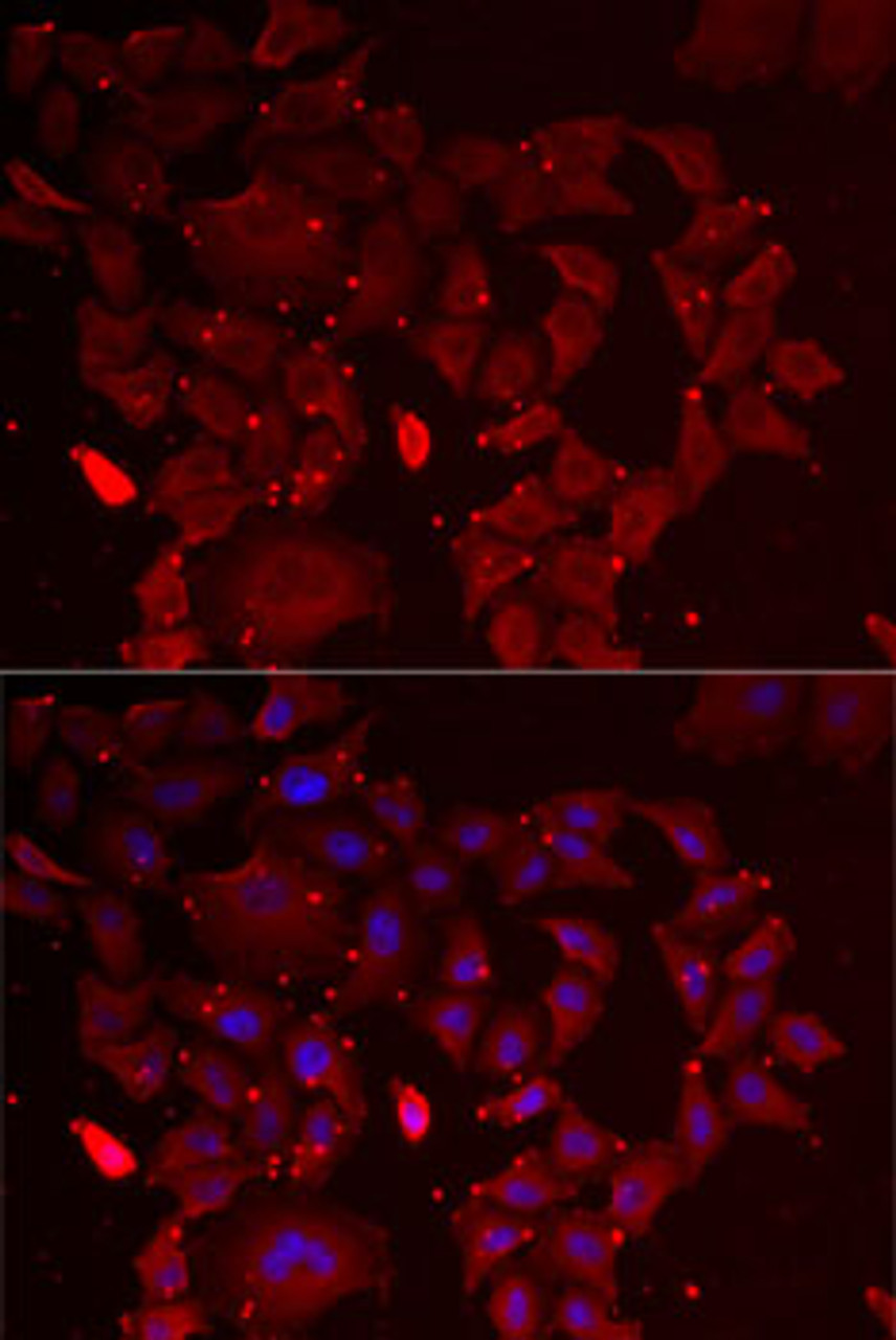 Immunofluorescence analysis of MCF7 cells using ADSS antibody (22-278) . Blue: DAPI for nuclear staining.