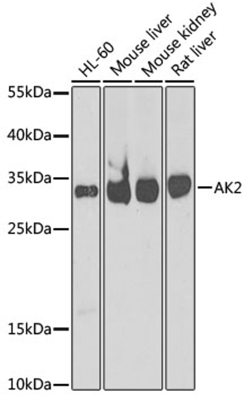 Western blot analysis of extracts of various cell lines, using AK2 antibody (22-281) at 1:1000 dilution.<br/>Secondary antibody: HRP Goat Anti-Rabbit IgG (H+L) at 1:10000 dilution.<br/>Lysates/proteins: 25ug per lane.<br/>Blocking buffer: 3% nonfat dry milk in TBST.<br/>Detection: ECL Basic Kit.<br/>Exposure time: 90s.