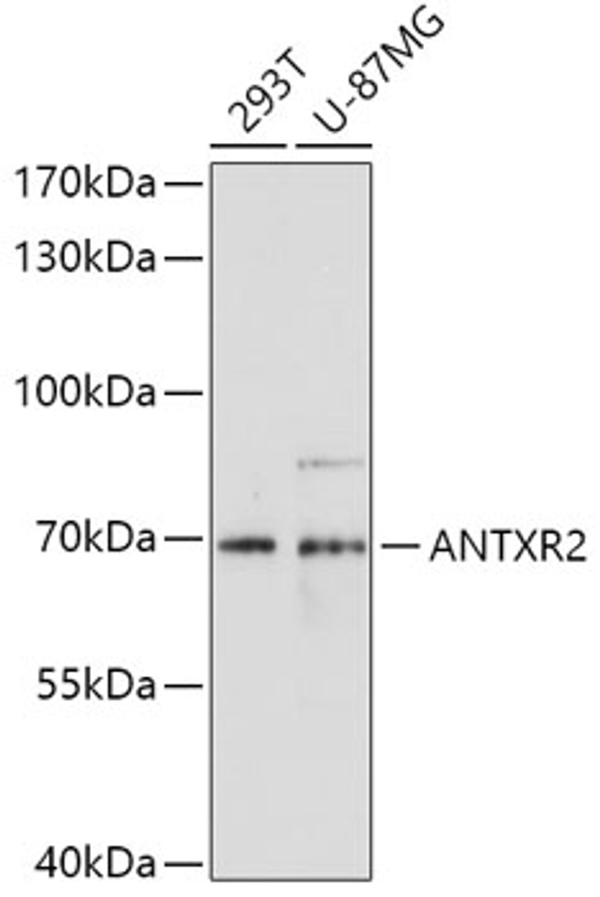 Western blot analysis of extracts of various cell lines, using ANTXR2 antibody (22-287) at 1:1000 dilution.<br/>Secondary antibody: HRP Goat Anti-Rabbit IgG (H+L) at 1:10000 dilution.<br/>Lysates/proteins: 25ug per lane.<br/>Blocking buffer: 3% nonfat dry milk in TBST.<br/>Detection: ECL Enhanced Kit.<br/>Exposure time: 60s.