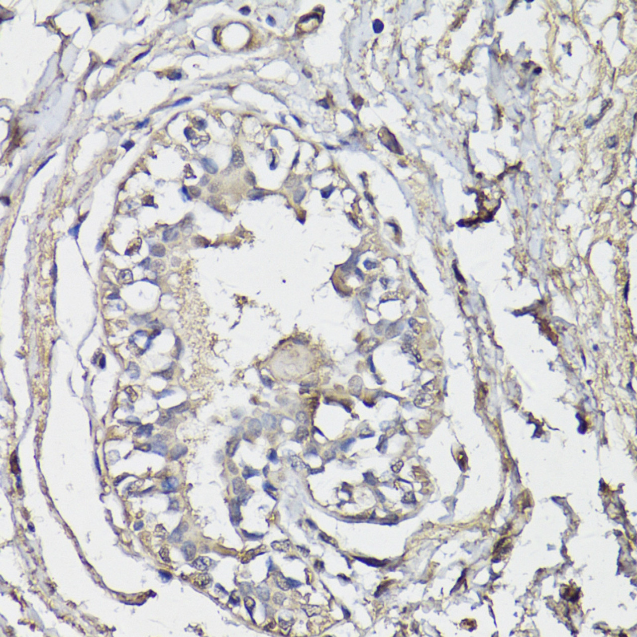 Immunohistochemistry of paraffin-embedded human breast using BAP1 antibody (22-291) at dilution of 1:150 (40x lens) .