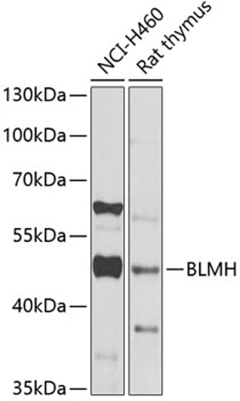Western blot analysis of extracts of various cell lines, using BLMH Antibody (22-293) at 1:1000 dilution.<br/>Secondary antibody: HRP Goat Anti-Rabbit IgG (H+L) at 1:10000 dilution.<br/>Lysates/proteins: 25ug per lane.<br/>Blocking buffer: 3% nonfat dry milk in TBST.<br/>Detection: ECL Basic Kit.<br/>Exposure time: 30s.