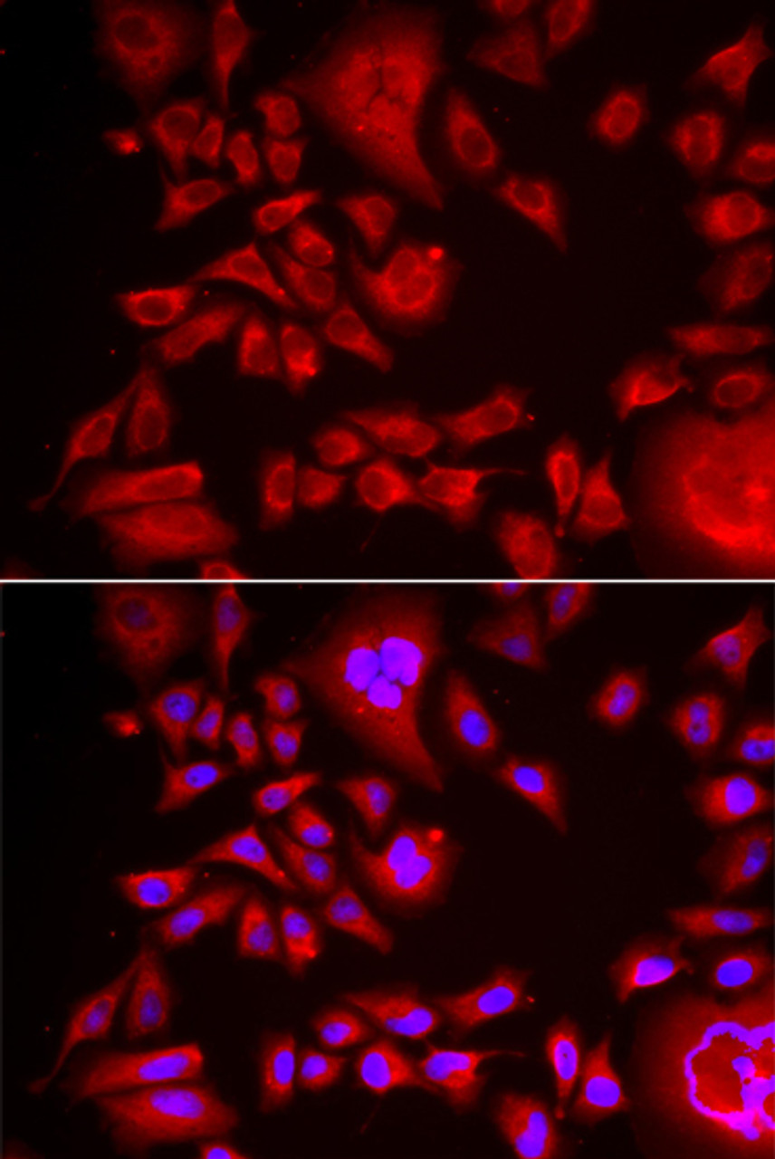 Immunofluorescence analysis of HeLa cells using BLMH antibody (22-293) . Blue: DAPI for nuclear staining.