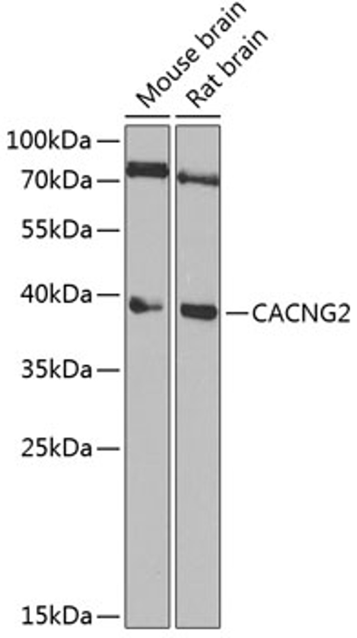 Western blot analysis of extracts of various cell lines, using CACNG2 Antibody (22-294) at 1:1000 dilution.<br/>Secondary antibody: HRP Goat Anti-Rabbit IgG (H+L) at 1:10000 dilution.<br/>Lysates/proteins: 25ug per lane.<br/>Blocking buffer: 3% nonfat dry milk in TBST.<br/>Detection: ECL Basic Kit.<br/>Exposure time: 10s.