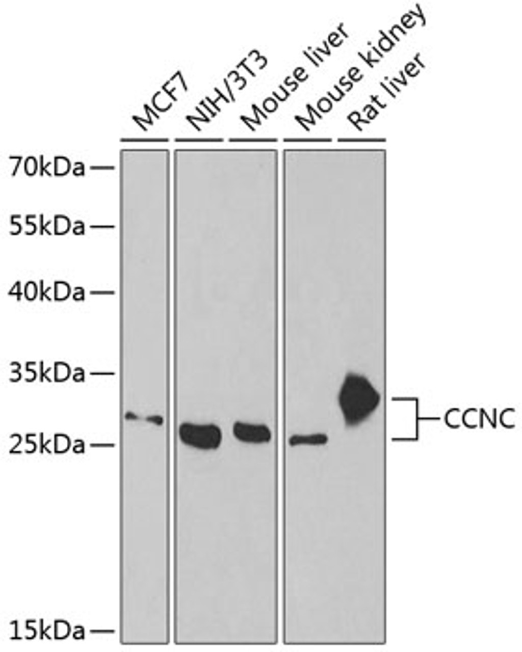 Western blot analysis of extracts of various cell lines, using CCNC antibody (22-301) at 1:1000 dilution.<br/>Secondary antibody: HRP Goat Anti-Rabbit IgG (H+L) at 1:10000 dilution.<br/>Lysates/proteins: 25ug per lane.<br/>Blocking buffer: 3% nonfat dry milk in TBST.<br/>Detection: ECL Basic Kit.<br/>Exposure time: 60s.