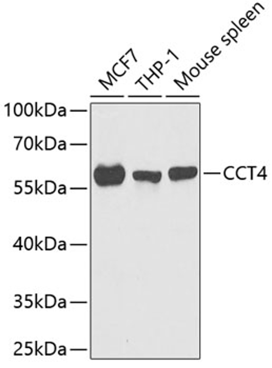 Western blot analysis of extracts of various cell lines, using CCT4 antibody (22-304) at 1:1000 dilution.<br/>Secondary antibody: HRP Goat Anti-Rabbit IgG (H+L) at 1:10000 dilution.<br/>Lysates/proteins: 25ug per lane.<br/>Blocking buffer: 3% nonfat dry milk in TBST.<br/>Detection: ECL Basic Kit.<br/>Exposure time: 90s.
