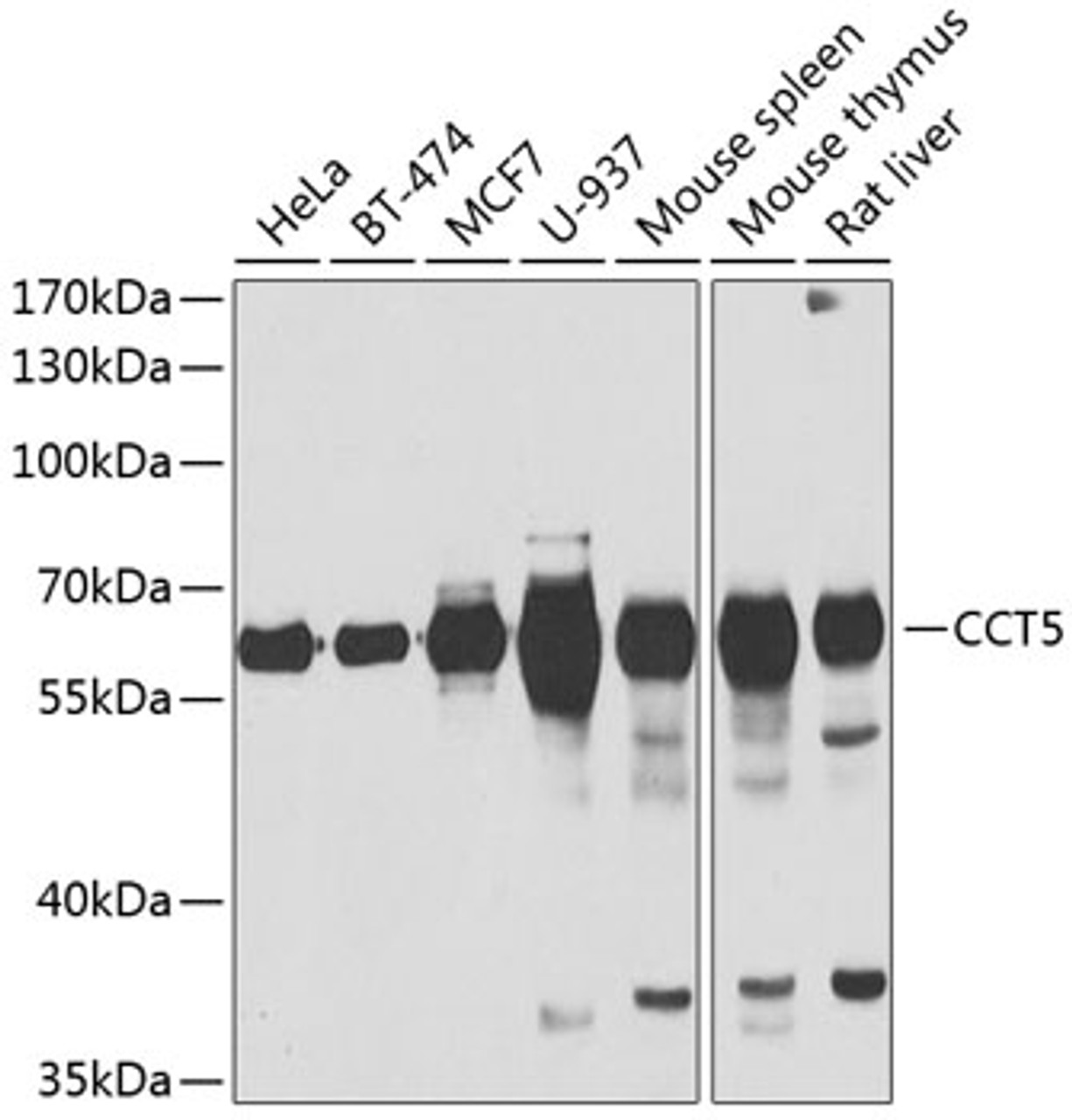 Western blot analysis of extracts of various cell lines, using CCT5 antibody (22-305) at 1:1000 dilution.<br/>Secondary antibody: HRP Goat Anti-Rabbit IgG (H+L) at 1:10000 dilution.<br/>Lysates/proteins: 25ug per lane.<br/>Blocking buffer: 3% nonfat dry milk in TBST.<br/>Detection: ECL Basic Kit.<br/>Exposure time: 30s.