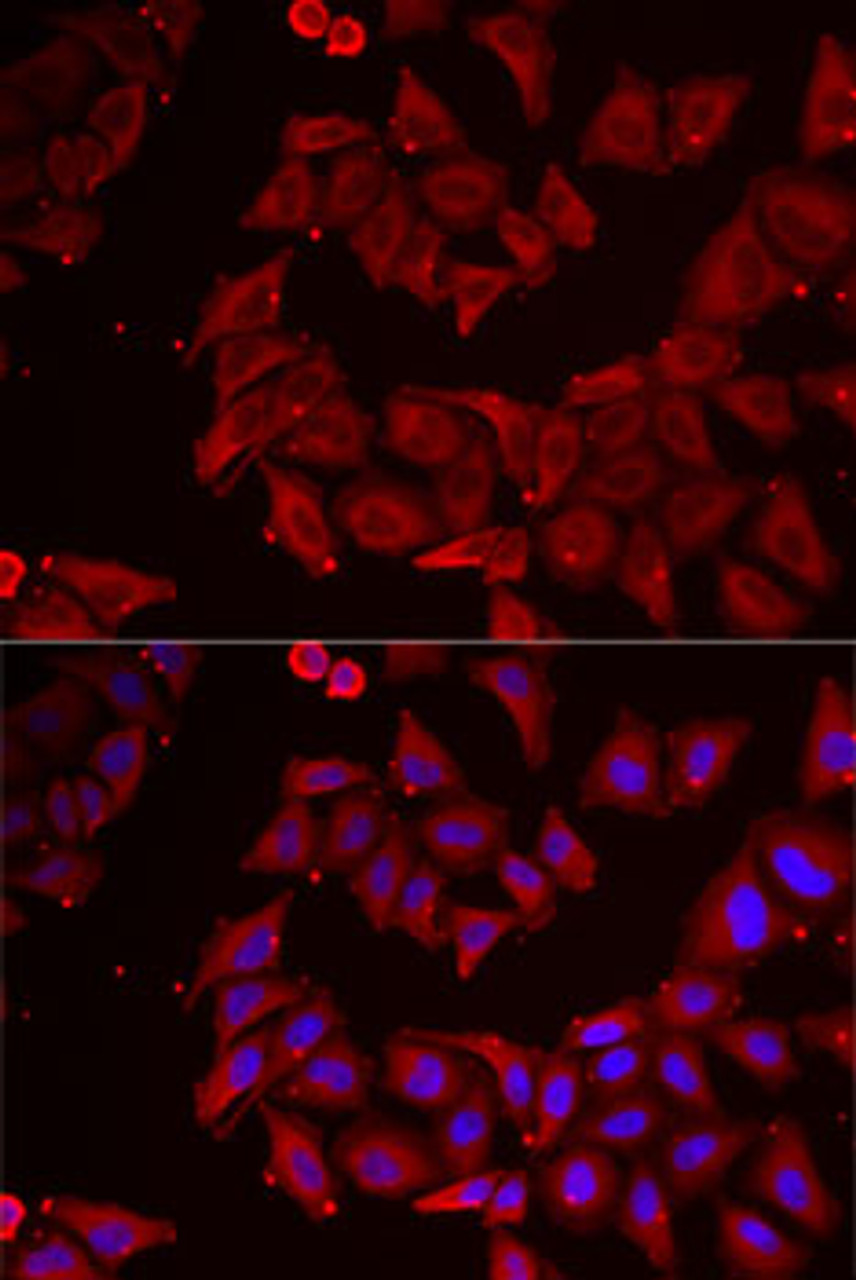 Immunofluorescence analysis of MCF7 cells using CMPK1 antibody (22-313) . Blue: DAPI for nuclear staining.