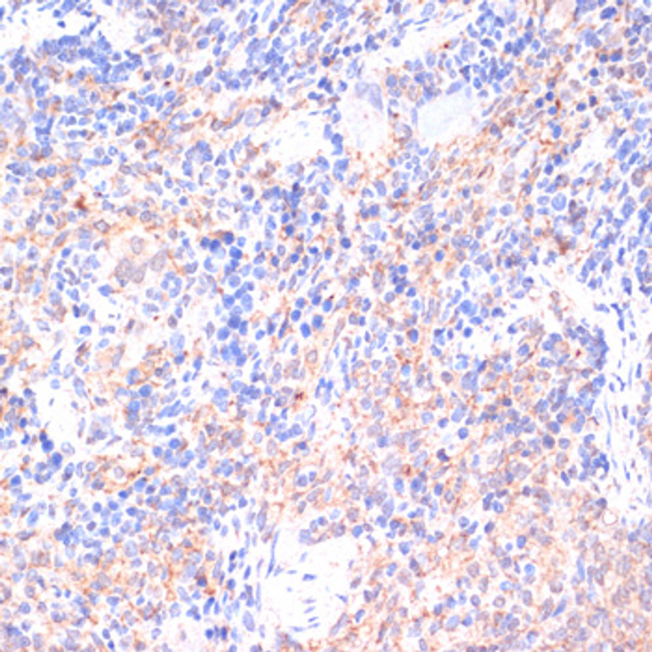 Immunohistochemistry of paraffin-embedded rat spleen using COX IV antibody (22-315) at dilution of 1:100 (40x lens) .