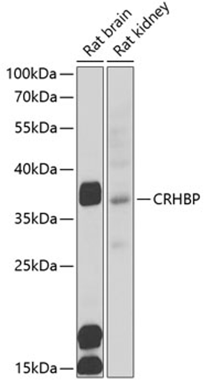 Western blot analysis of extracts of various cell lines, using CRHBP antibody (22-319) at 1:1000 dilution.<br/>Secondary antibody: HRP Goat Anti-Rabbit IgG (H+L) at 1:10000 dilution.<br/>Lysates/proteins: 25ug per lane.<br/>Blocking buffer: 3% nonfat dry milk in TBST.<br/>Detection: ECL Basic Kit.<br/>Exposure time: 90s.