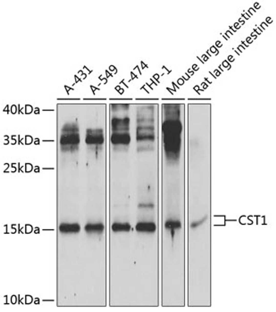 Western blot analysis of extracts of various cell lines, using CST1 Antibody (22-321) at 1:1000 dilution.<br/>Secondary antibody: HRP Goat Anti-Rabbit IgG (H+L) at 1:10000 dilution.<br/>Lysates/proteins: 25ug per lane.<br/>Blocking buffer: 3% nonfat dry milk in TBST.<br/>Detection: ECL Basic Kit.<br/>Exposure time: 30s.