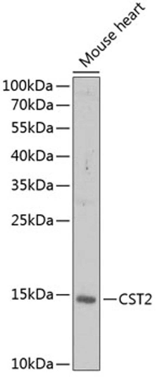 Western blot analysis of extracts of mouse heart, using CST2 antibody (22-322) at 1:1000 dilution.<br/>Secondary antibody: HRP Goat Anti-Rabbit IgG (H+L) at 1:10000 dilution.<br/>Lysates/proteins: 25ug per lane.<br/>Blocking buffer: 3% nonfat dry milk in TBST.<br/>Detection: ECL Enhanced Kit.<br/>Exposure time: 5min.