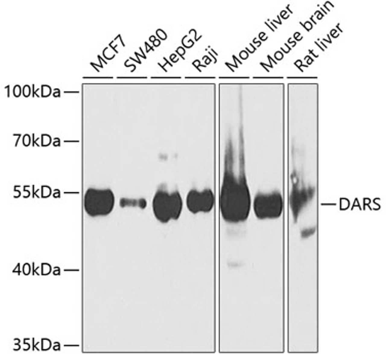 Western blot analysis of extracts of various cell lines, using DARS Antibody (22-323) at 1:1000 dilution.<br/>Secondary antibody: HRP Goat Anti-Rabbit IgG (H+L) at 1:10000 dilution.<br/>Lysates/proteins: 25ug per lane.<br/>Blocking buffer: 3% nonfat dry milk in TBST.<br/>Detection: ECL Basic Kit.<br/>Exposure time: 90s.