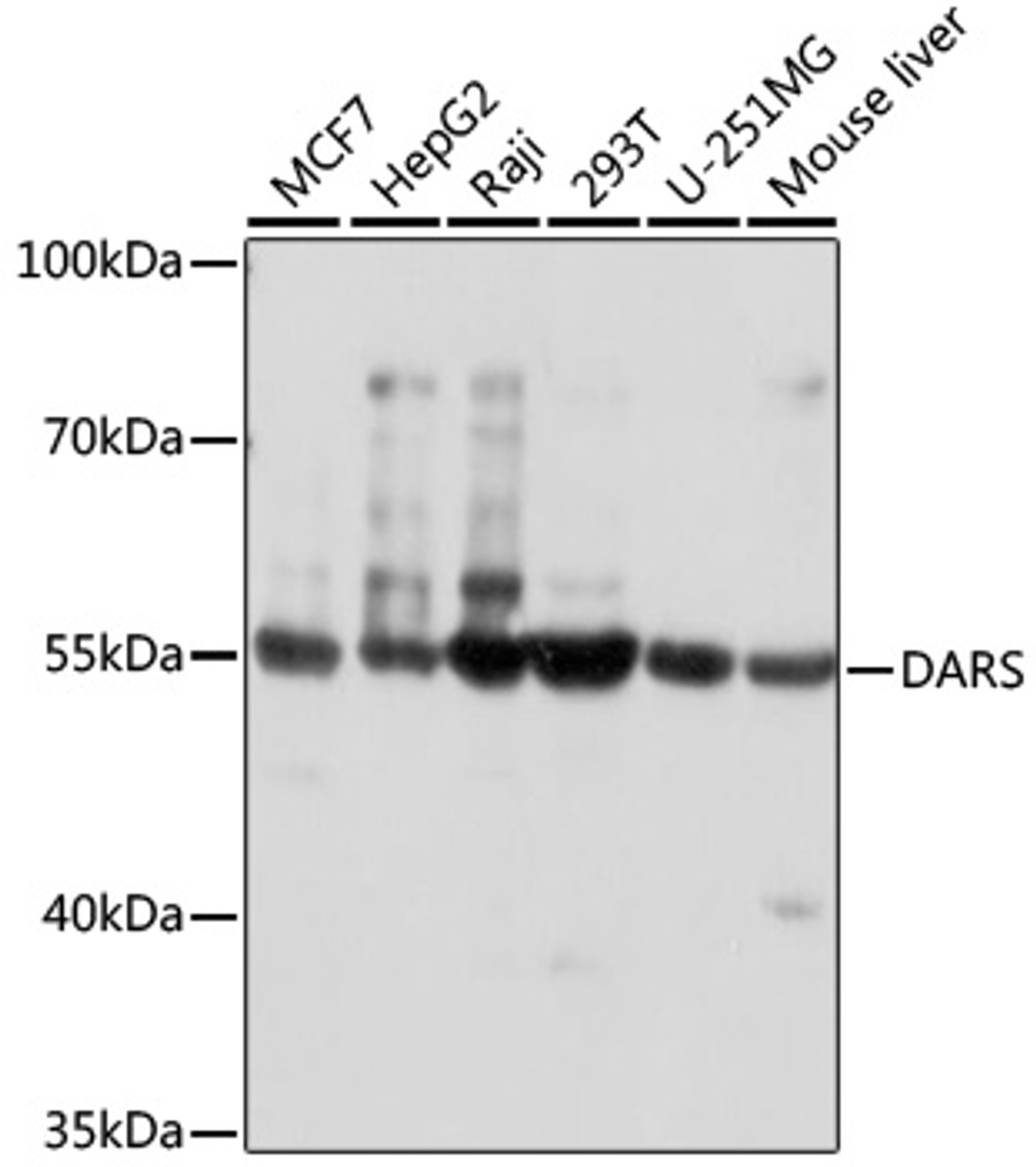 Immunohistochemistry of paraffin-embedded rat brain using DARS antibody (22-323) at dilution of 1:100 (40x lens) .