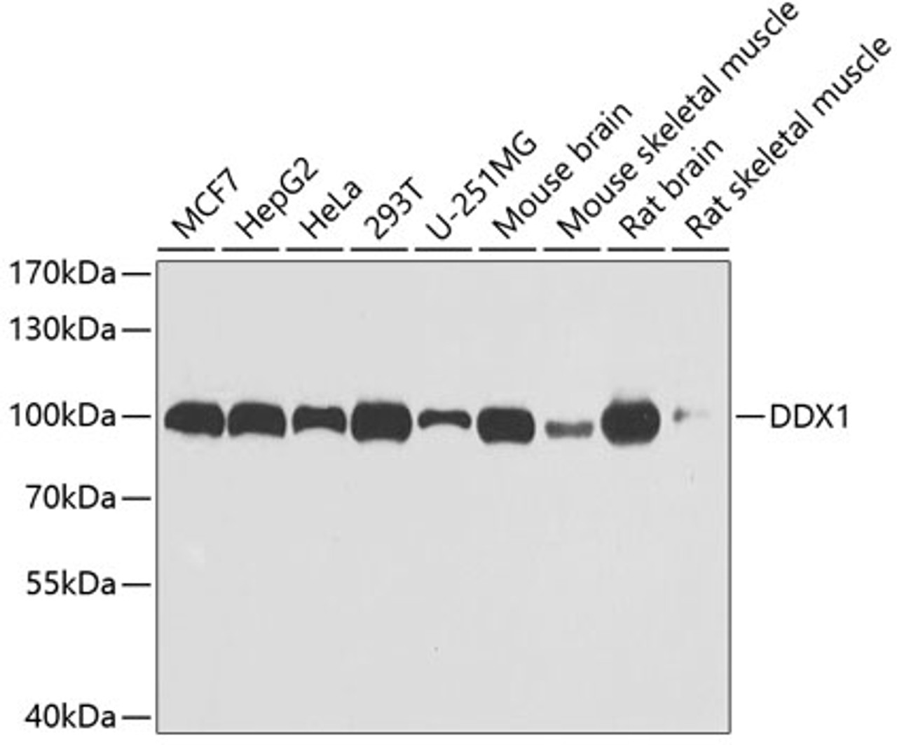Western blot analysis of extracts of various cell lines, using DDX1 antibody (22-324) at 1:1000 dilution.<br/>Secondary antibody: HRP Goat Anti-Rabbit IgG (H+L) at 1:10000 dilution.<br/>Lysates/proteins: 25ug per lane.<br/>Blocking buffer: 3% nonfat dry milk in TBST.<br/>Detection: ECL Basic Kit.<br/>Exposure time: 10s.