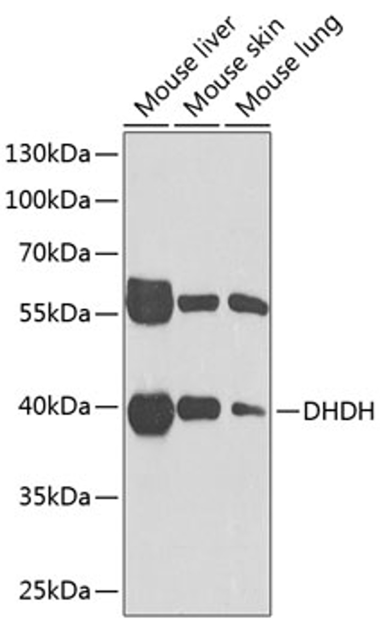 Western blot analysis of extracts of various cell lines, using DHDH Antibody (22-326) at 1:1000 dilution.<br/>Secondary antibody: HRP Goat Anti-Rabbit IgG (H+L) at 1:10000 dilution.<br/>Lysates/proteins: 25ug per lane.<br/>Blocking buffer: 3% nonfat dry milk in TBST.<br/>Detection: ECL Basic Kit.<br/>Exposure time: 30s.