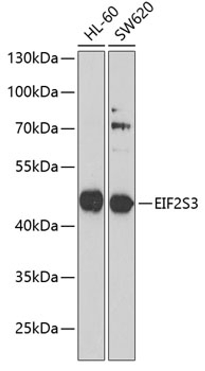 Western blot analysis of extracts of various cell lines, using EIF2S3 antibody (22-329) at 1:1000 dilution.<br/>Secondary antibody: HRP Goat Anti-Rabbit IgG (H+L) at 1:10000 dilution.<br/>Lysates/proteins: 25ug per lane.<br/>Blocking buffer: 3% nonfat dry milk in TBST.<br/>Detection: ECL Basic Kit.<br/>Exposure time: 90s.