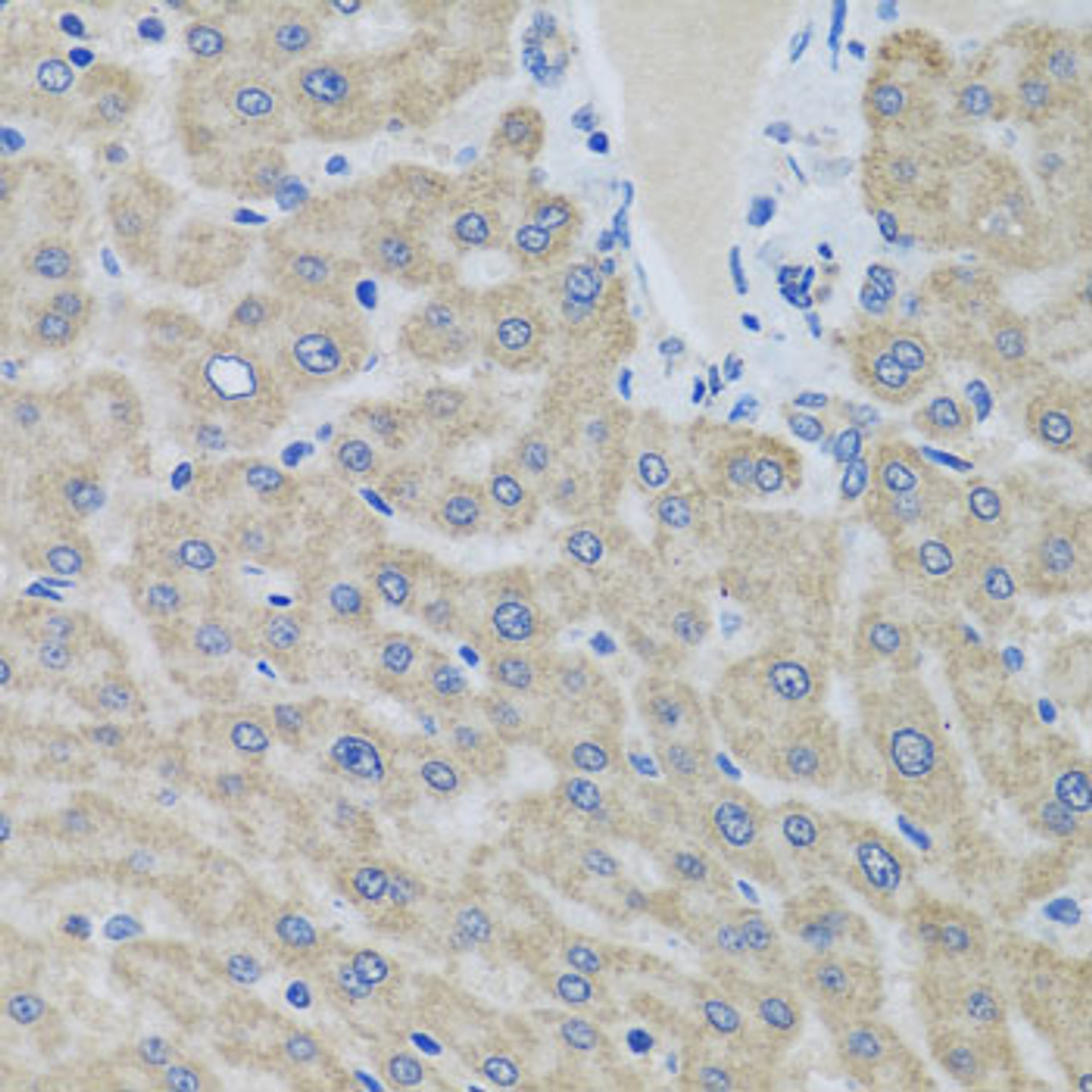 Immunohistochemistry of paraffin-embedded human liver using EIF2S3 antibody (22-329) at dilution of 1:100 (40x lens) .